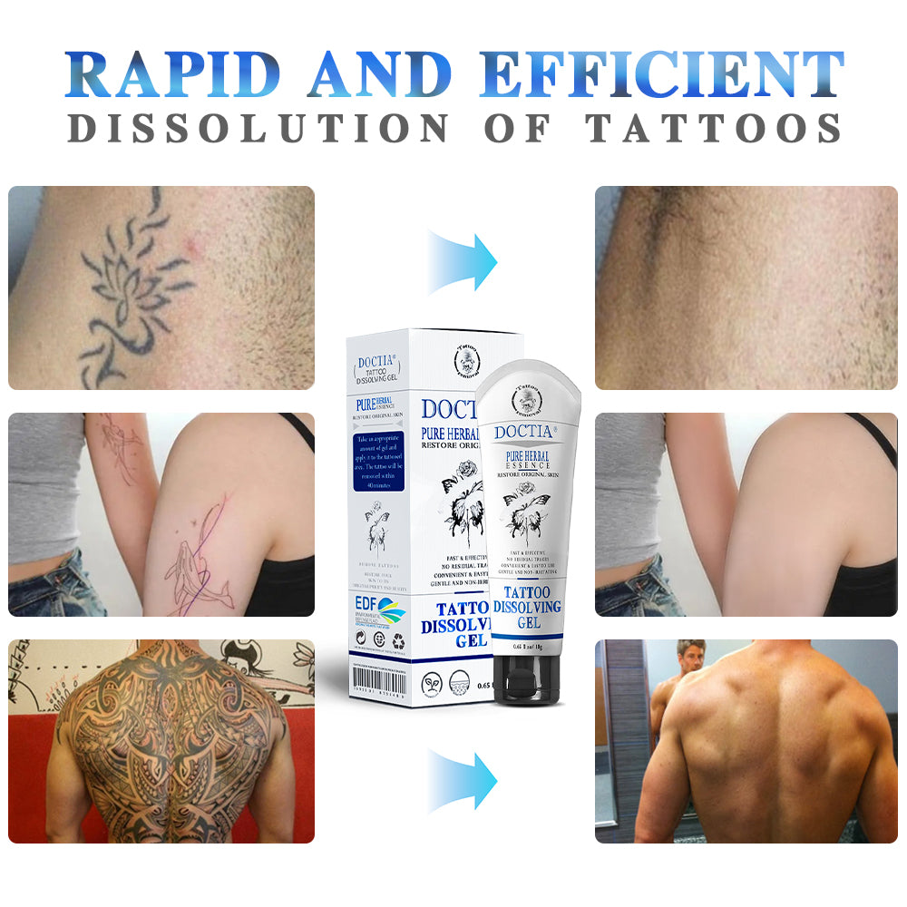 Doctia™ Tattoo Removal Cream - Fast and effective tattoo removal cream, permanent tattoo removal - skin pigment removal - painless - fast absorption - no scars